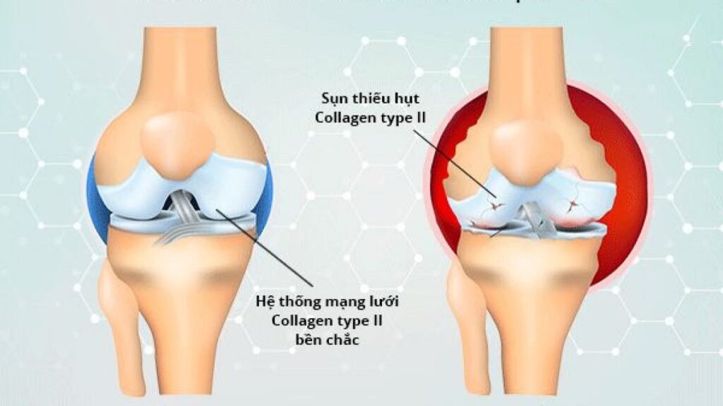 Ứng dụng collagen vào tăng cường độ chắc khỏe của xương khớp.