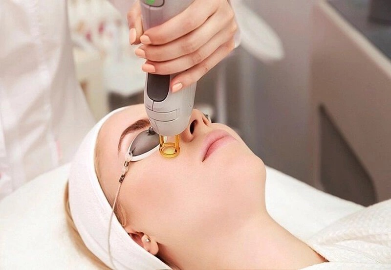 Trẻ hoá da mặt bằng công nghệ laser