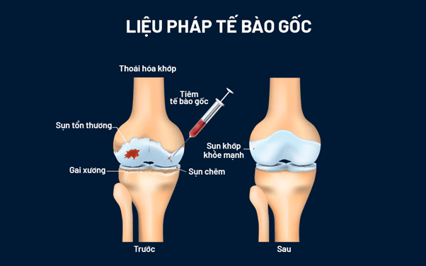 Tiềm năng ứng dụng trong y học của tế bào gốc toàn năng