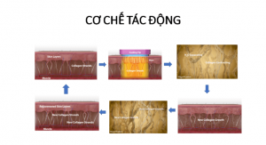 Cơ chế tác động của công nghệ Thermage