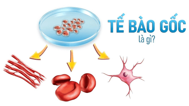 Tế bào gốc là gì?