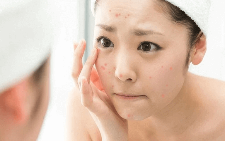 Dùng sữa rửa mặt dạng gel 