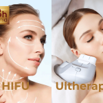 So sánh công nghệ hifu là ultherapy