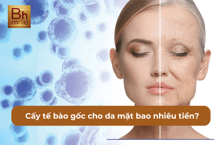 CẤY TẾ BÀO GỐC CHO DA MẶT BAO NHIÊU TIỀN