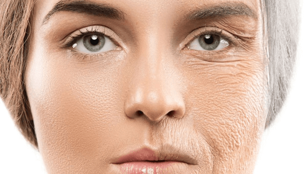 nâng cơ HIFU có tác hại gì không