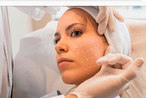 Phương pháp Skin booster