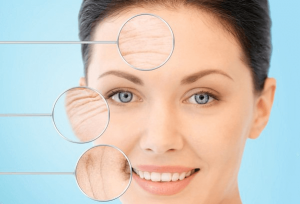 Thermage phù hợp với người có nếp nhăn, có làn da chảy xệ